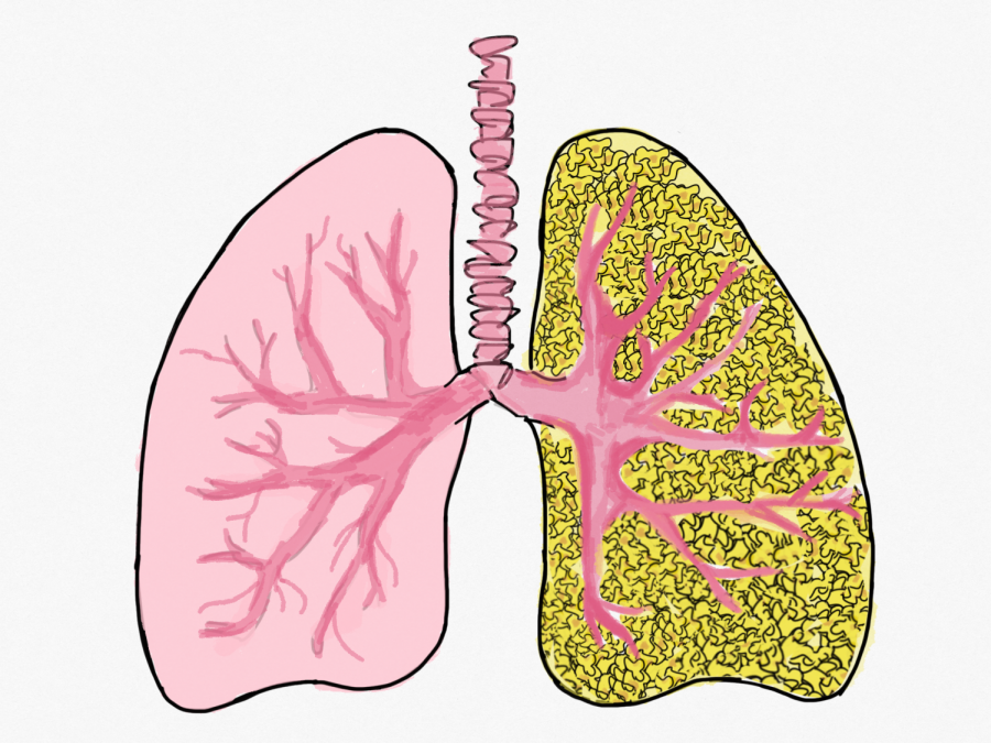 Popcorn+Lung%3A+Health+Risks+and+Other+Side+Effects+Surrounding+Vaping